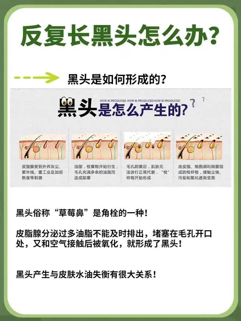 反复长黑头怎么办71教你去黑头保姆级教程75.黑头!
