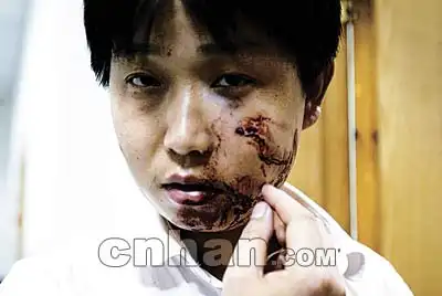 姑嫂树路昨发枪战 面包车探出霰弹枪射伤3路人