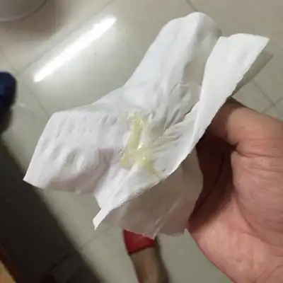 问答 怀孕期 推荐回答                      我也是这几天有这个东西