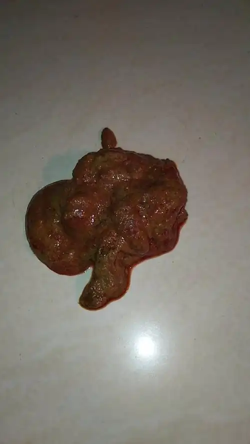 我家狗狗大便稀,拉血,求参考一下