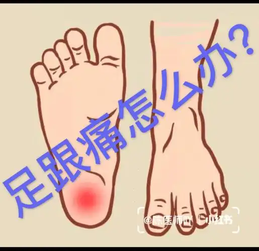 足跟痛浸泡方轻轻松松解决疼痛
