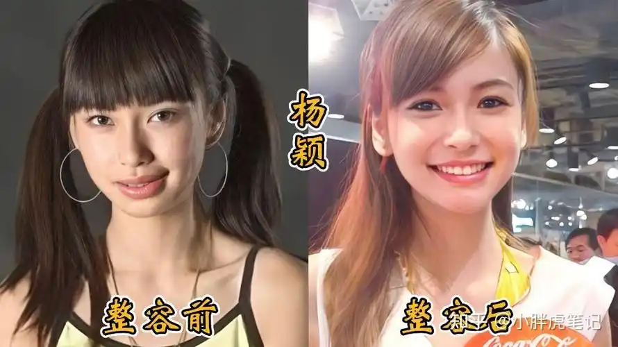 18位女明星整容前后对比邵音音面目全非杨颖堪称整容模板