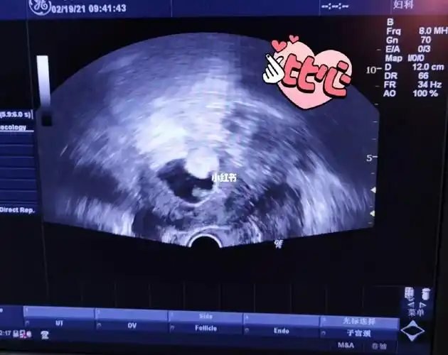 茄子形状的98~是男是女?