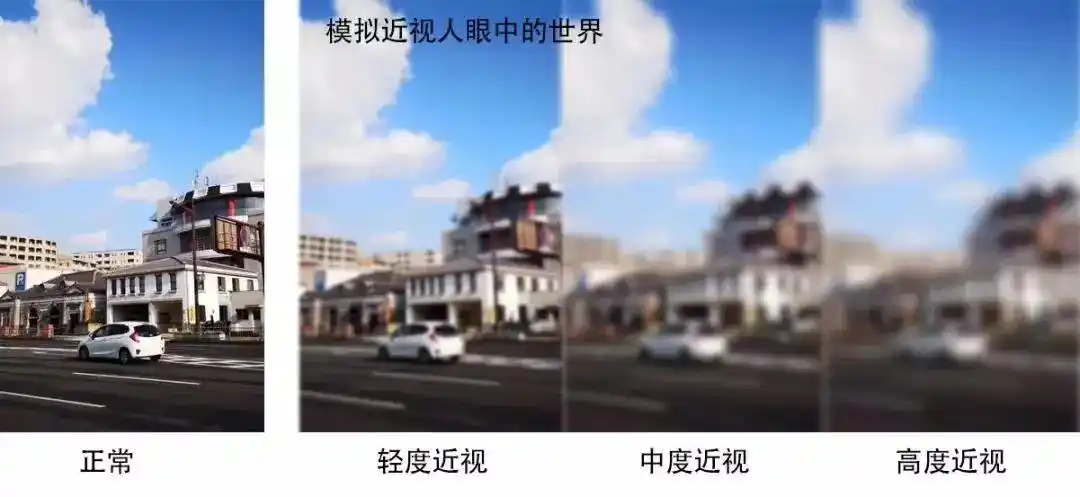 用不了半年时间,大多数孩子的近视就会转化成高度近视(儿童300度就被