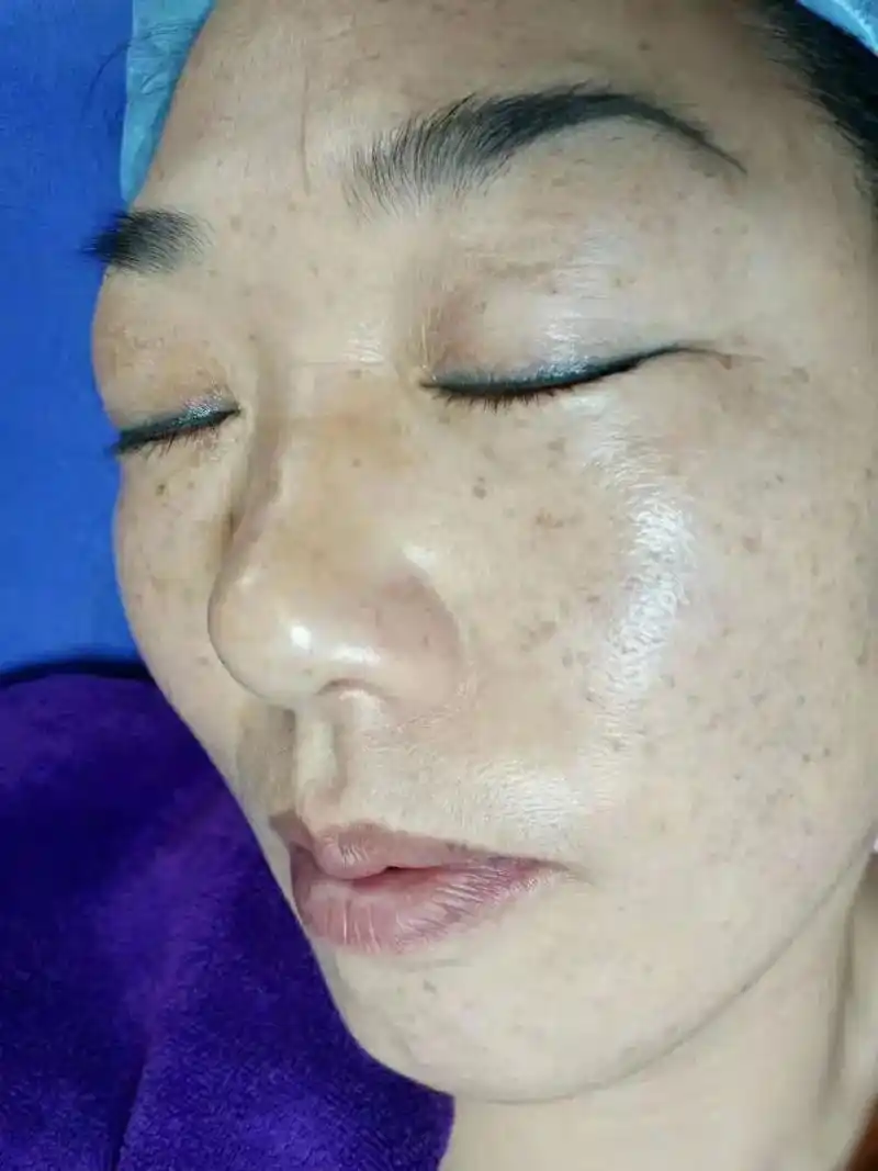 纯中药提取斑点,让你实实在在的享受到的效果#皮肤管理 欢迎 - 抖音