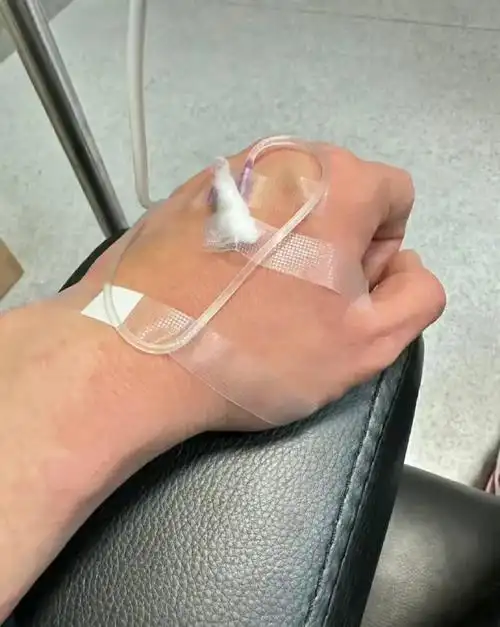 得了肠胃炎和急性荨麻疹,手上胳膊上都是过敏的症状,人现在还在输液