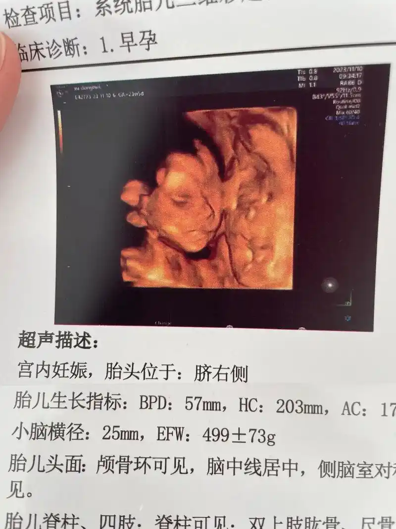 小可爱的第一张照片