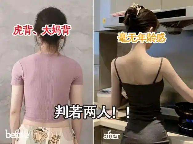 驼背女孩都在用每天10分钟肩直了富贵包不见了背越来越薄