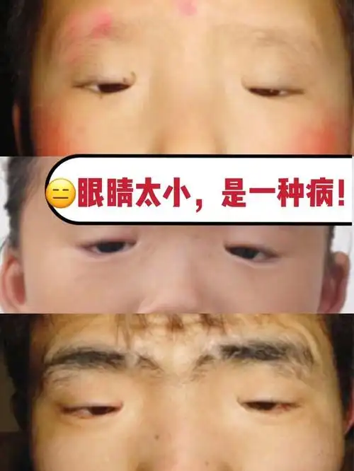 作为整形医生,都会碰到各种各样的眼睛,单眼皮的,上_圈子-新氧美容