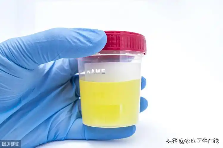 5,黄疸当肝脏系统发生问题时会让胆红素升高,而这些胆红素会通过尿液