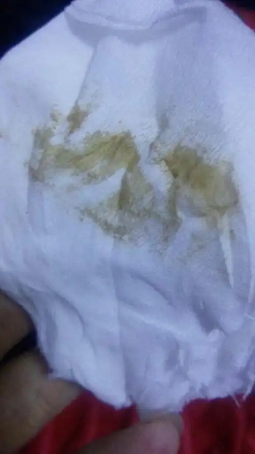 月经血为什么发给?卫生巾上看着颜色更深,这是擦了一下拍的.