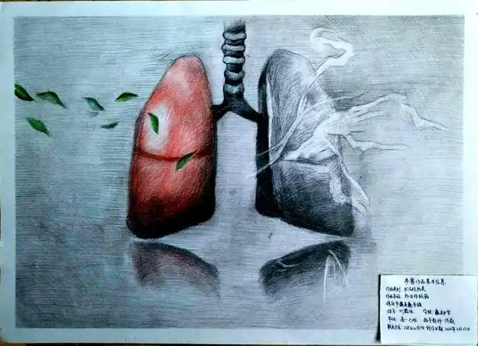 保定市首届结核病防治知识优秀宣传获奖作品绘画类