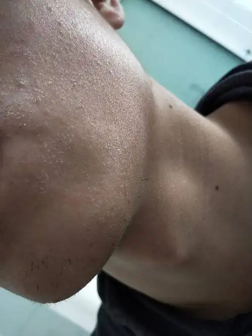 为什么我脸上起皮这么严重,这是什么病?