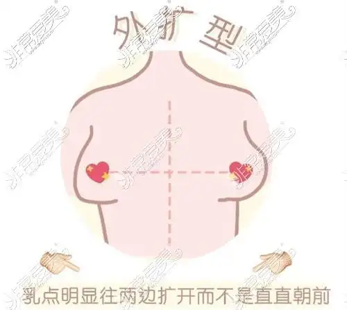 两胸之间多少厘米算外扩?记住:超过一掌长就是外扩!-非常爱美