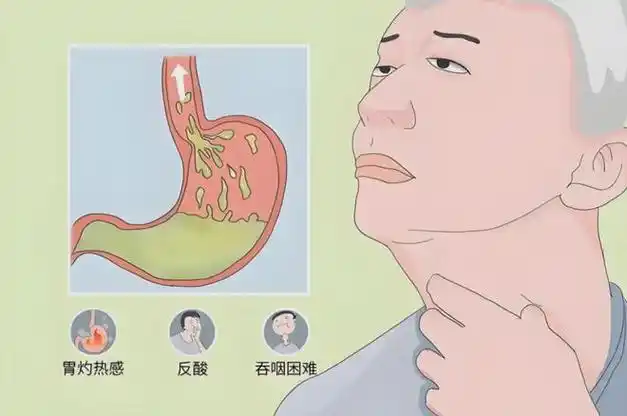 郑州民生耳鼻喉医院:咽喉不适咳不出来又咽不下去?可能不是咽炎