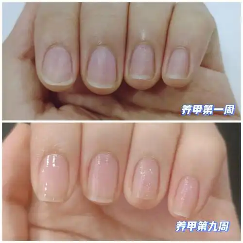 天呐!甲床真的长了06