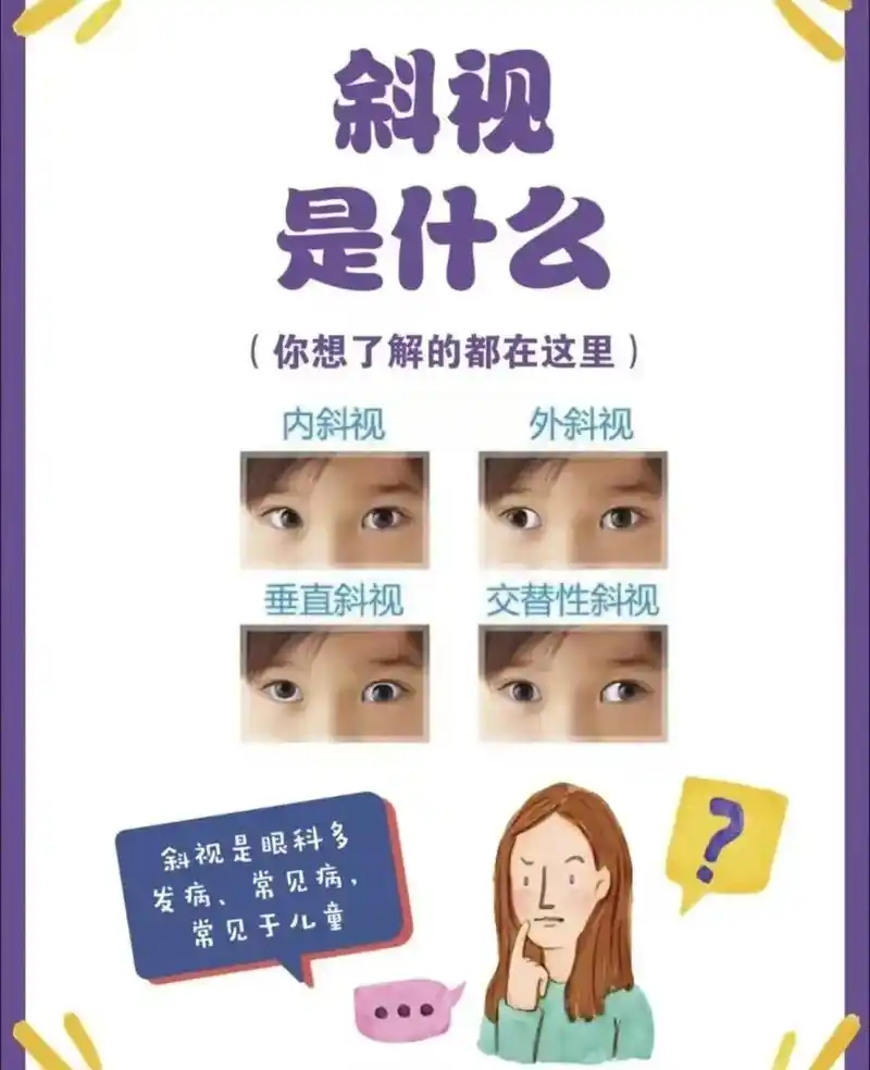 造成斜视的原因有哪些? 斜视有很多种类型,比如先天性斜视,屈 - 抖音