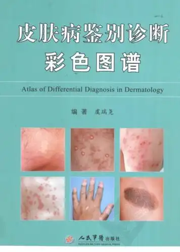 皮肤病鉴别诊断彩色图谱