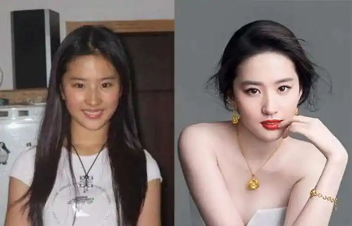 明星整容前后明星成名前后对比照大合集