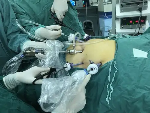 由于肿瘤体积较大,若采用传统开腹手术切口大且恢复慢,在与家属进行