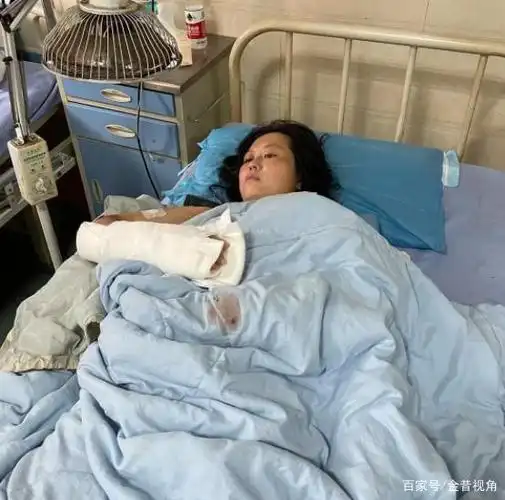 杨世琴双臂,双腿缠满了绷带,全身多处受伤,躺在宜宾南溪区中医院的