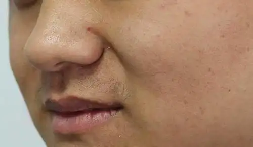 42岁男子确诊肝癌化疗2次去世医生叹息1种饮品常喝肝早已烂如蜂窝