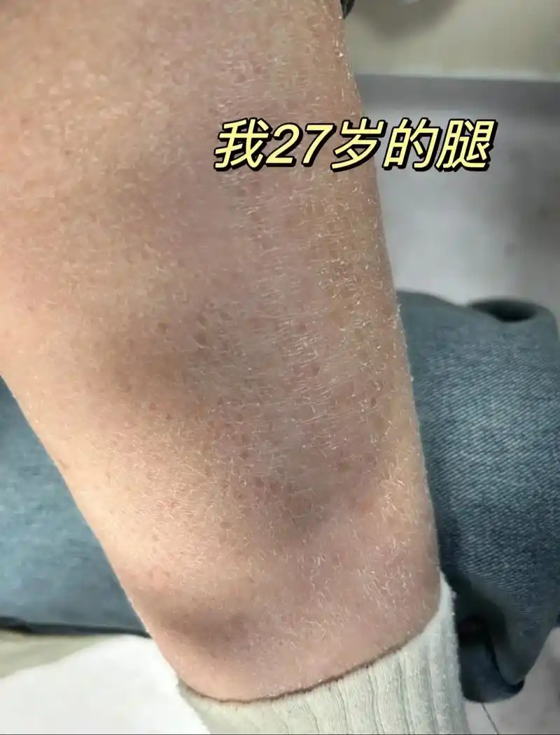 姐妹们,秋冬干燥缺水,针对 皮肤干燥/卡皮/粗糙的姐们的必备身体乳