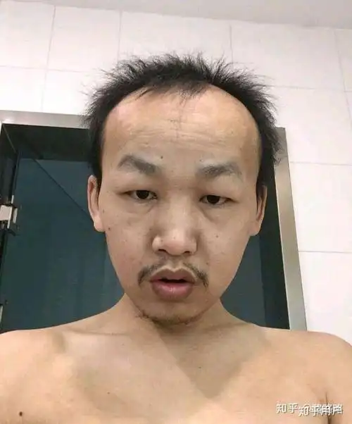 我想知道什么样算丑 ?