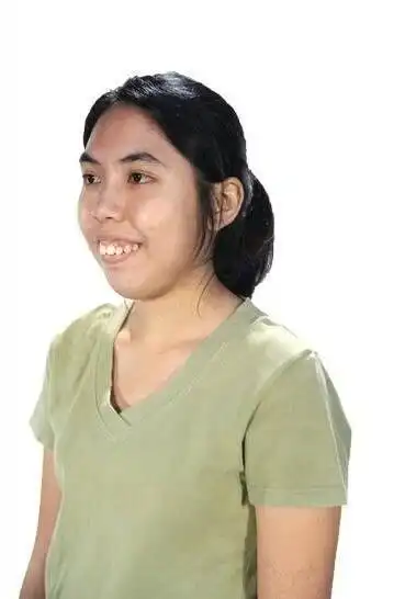 23岁越南女子又黑又丑如同大妈整容10多次后被无数男孩子追求