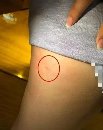 女子入住长沙一星级酒店被床上隐藏的针扎伤要求开具承担风险证明遭拒