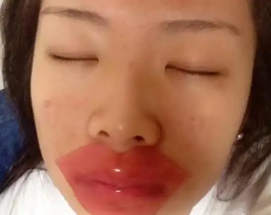 这种嘴型从名字就可以看的出来,这种嘴唇从远处看起来就像是