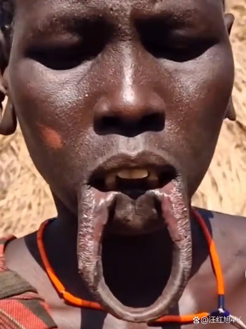 一位非洲奇人出现了,黑黑的面脸, 嘴的下唇脱离长出一个大个圆形肉环