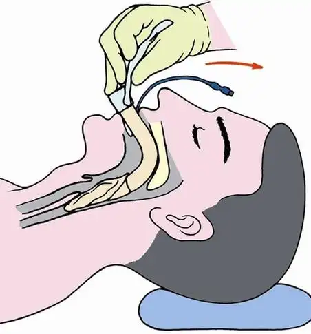 全国通用b超检查攻略,收藏就对了!