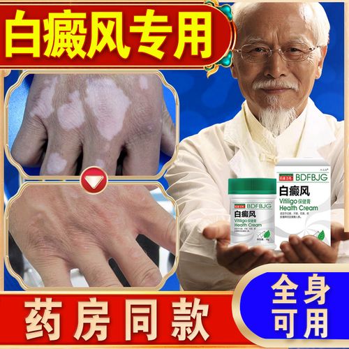 白癜风外用药黑色素生长古方汗斑净白斑克星专用治补骨脂酊专用膏