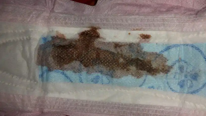 月经血为什么发黑?卫生巾上看着颜色更深.什么问题?身体哪里问题?