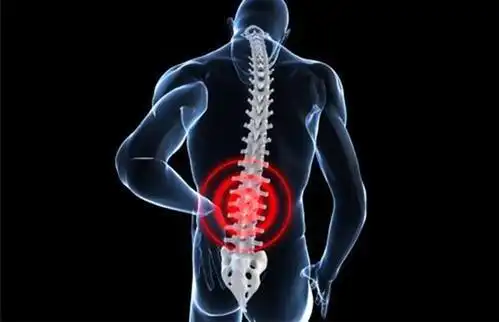 腰痛的中医认识