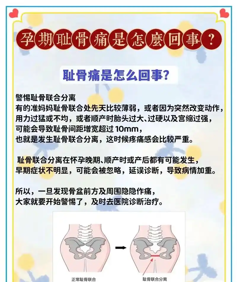 进入孕晚期,身体各种不适,尤其是耻骨痛! - 抖音