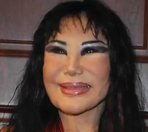 惨不忍睹!整容失败后的超恐怖照片全集