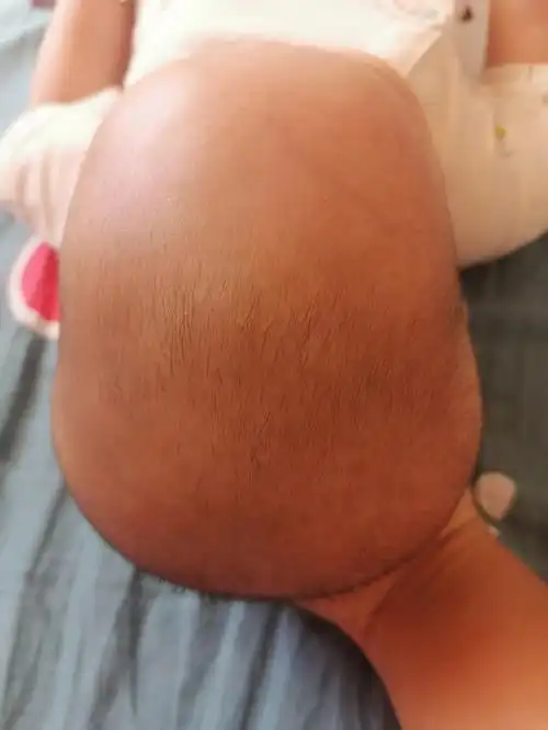 老师,麻烦看看我宝宝的头型,4个月了,太焦虑了,第一胎姐姐没睡头型