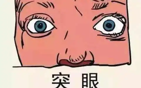 男人女人有金鱼眼面相命运如何 运势好不好