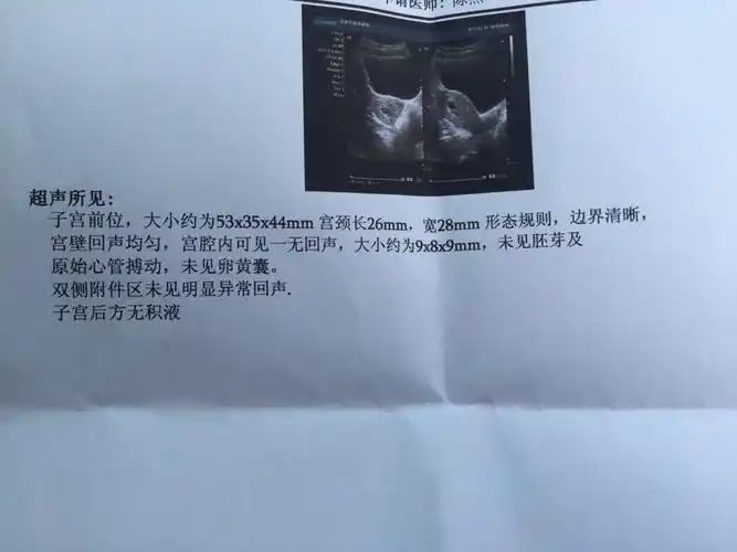 末次6.18做b超显示才40天,求解