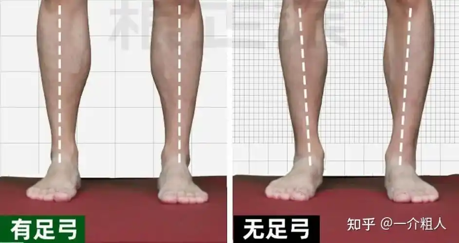 深度分析小腿骨变弯