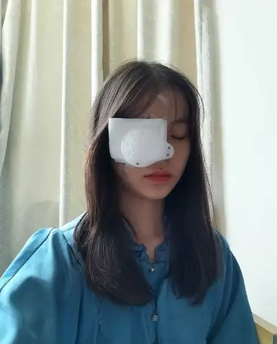 上午做了左眼七月十六号下午到医院做了右眼,第二天早上拆开纱布眼罩