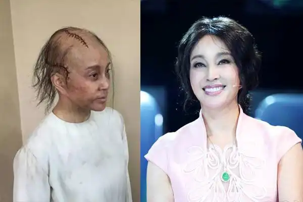 展开全部 是刘晓庆没错.我看过.