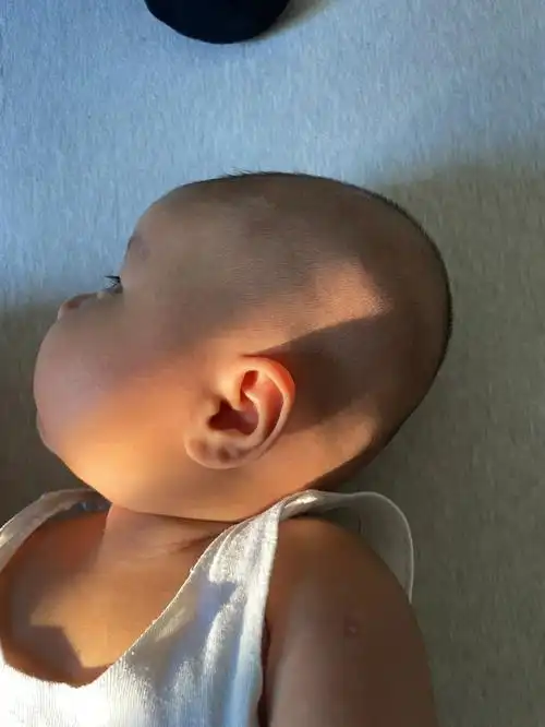 快3个月宝宝头型这样正常吗