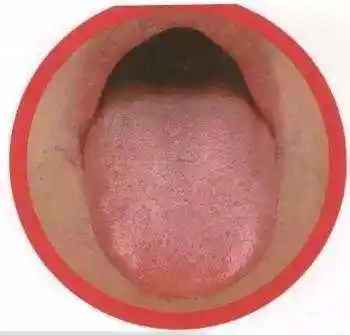 对着镜子看舌头, 就能快速知道自己是什么体质和隐疾!_网易订阅