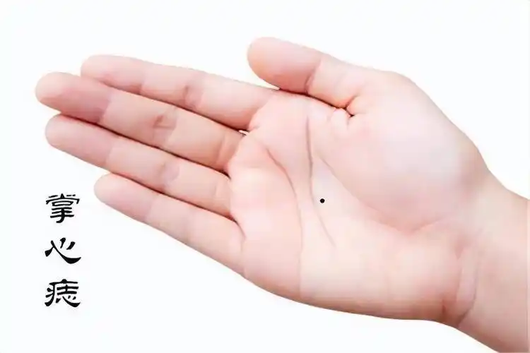 掌心痣很多人发现孩子的手掌心里有痣,代表着掌中宝多维大吉大利