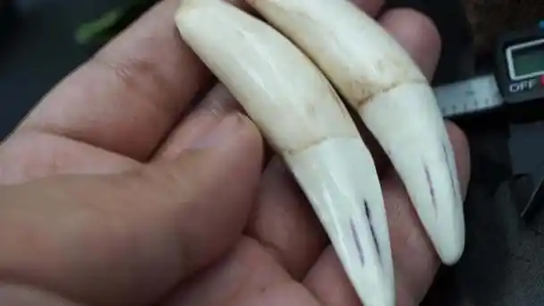 成年的老虎牙骨壁相当凸出,骨质丰满,整颗牙不会有