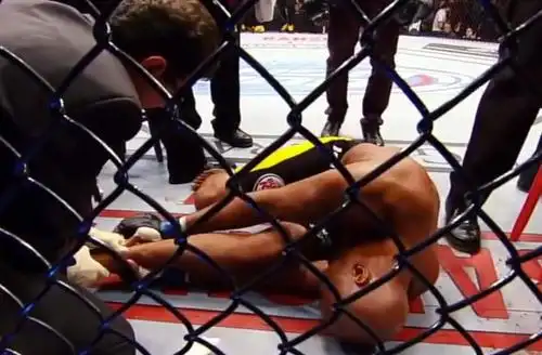 魏德曼惨遭乌利亚断腿!