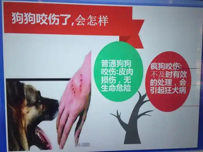 尽管狗狗是我们的好朋友,可是万一我们和狗狗发生矛盾了,被狗狗咬伤了
